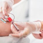 Does having a blood test or donating blood break the fast